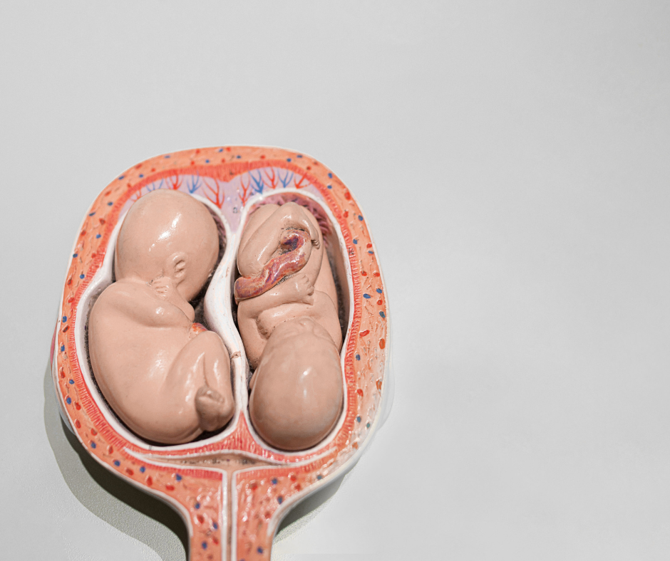 Ultrasonografia w ciąży bliźniaczej